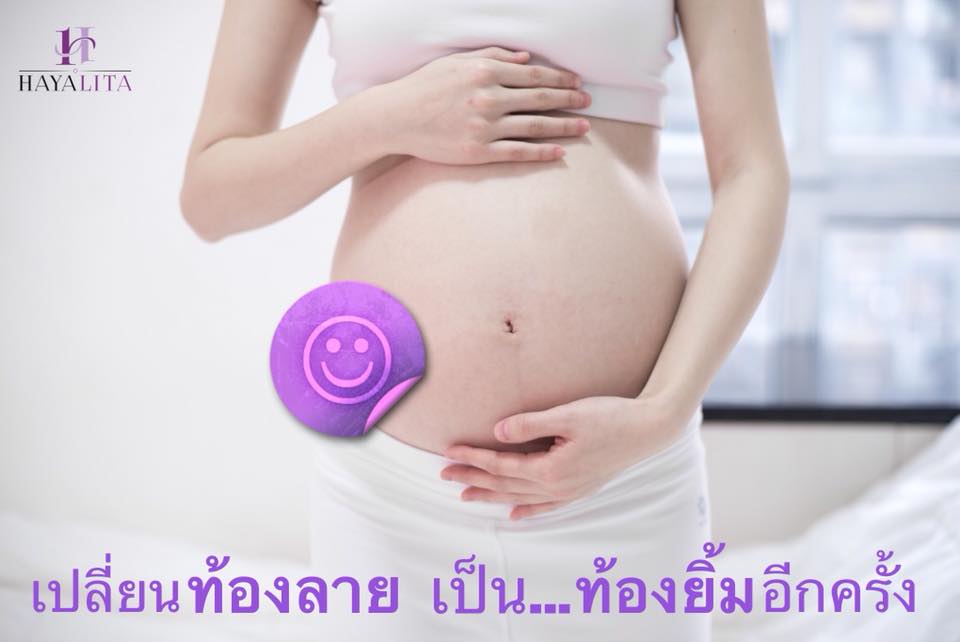 อาการท้องยิ้มได้